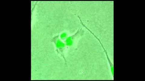 Breast cancer cells (MDA-MB-231) migrating in a 3D matrigel - Ivar Noordstra (Utrecht University)