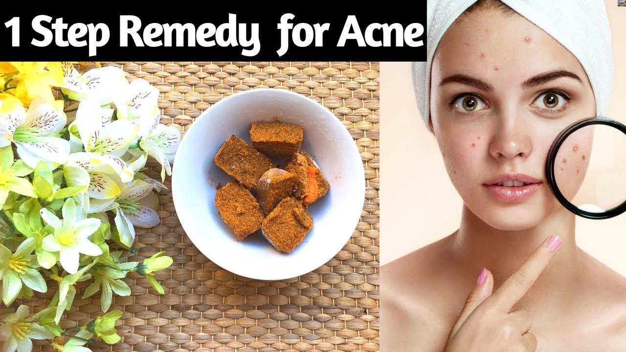 Home Made Ice Cubes Remedy For Acne Pimples In Hindi I Skin Care I Home Made Ice Cubes Remedy For Acne Pimples In Hindi I Skin Care I