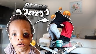 I Gave My Son A BLACK EYE To See How HIS MOM Would React!!! **THIS HAPPENED**