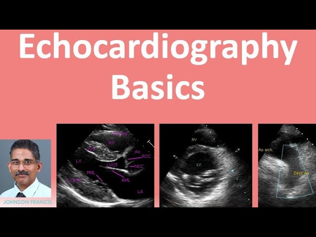 Echocardiography Basics class=