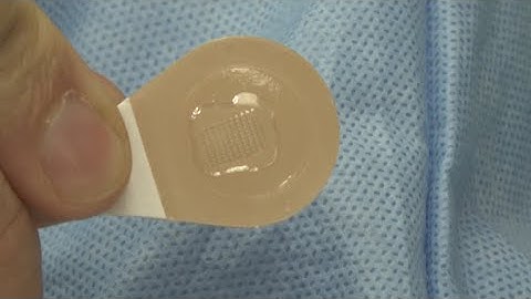 Flu vaccine skin patch could someday replace shots