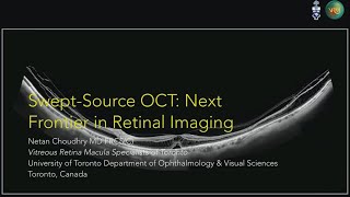 AAO 2018   “Swept Source OCT  Next Frontier in Retinal Imaging”