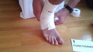 Ankle Taping | Tape Your Own Ankle (COMPLETE)