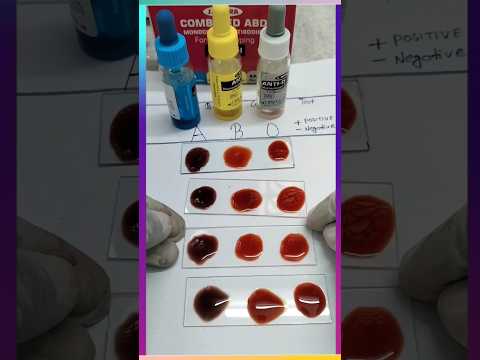 Blood group test