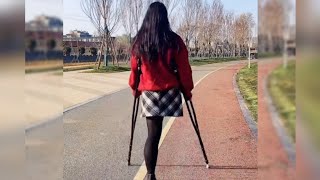 A Beautiful Lady With An Amputated Leg Walks With Crutches,(21)😍❤️#Amputee#Crutches #Amazing#Walking