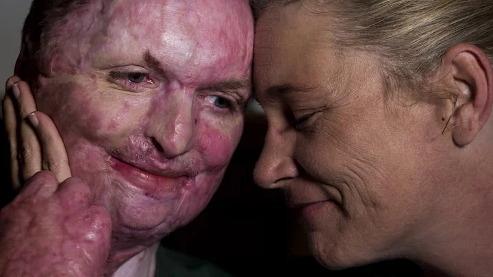 'I am me': Iconic Village fire survivor strives to...