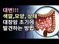 대변 색깔 모양 상태를 보고 대장암 초기에 발견하는 방법과 몸속 소화 기관의 건강 상태 확인 방법