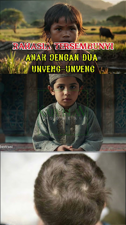 Keistimewaan Anak Dengan 2 Unyeng-Unyeng #feedshorts