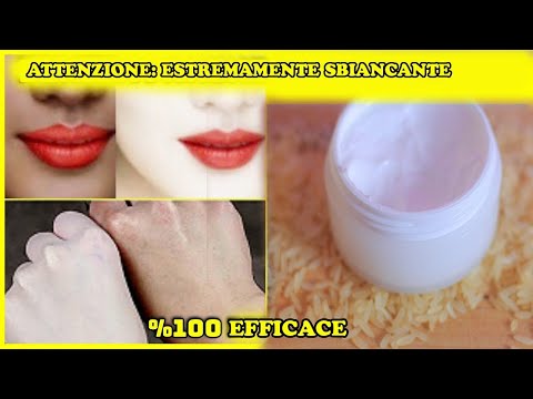 Video: Quale crema sbiancante è la migliore per la pelle scura?