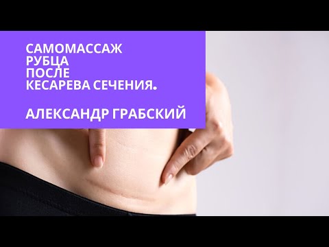 Кесарево сечение. Самомассаж рубца. Кинезиолог Александр Грабский.