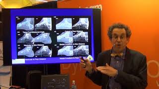 Dr.  Lew Schon Discusses Weight-Bearing Extremity Imaging