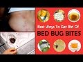 How To Treat Bed Bugs
