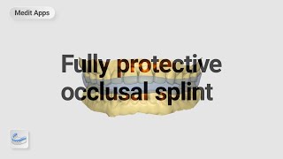 Designing a Fully Protective Occlusal Splint with the Splints App screenshot 5