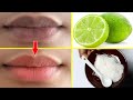 Get Soft Pink Lips Naturally Permanently | 100% Works At Home #2