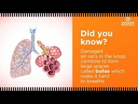 What is bullectomy surgery? Living Healthy with COPD!