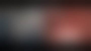 Robotic lobectomy port placement and docking