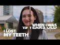 My Medication Left Me With No Teeth | SHAKE MY BEAUTY