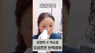 포텐자 셀프시술 직접 보여드려요❤️리얼시술 ASMR (w.엑소좀)