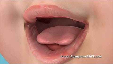 Breastfeeding Problems