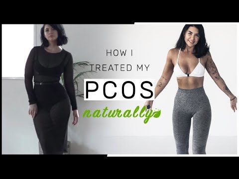 How I Treated My PCOS Naturally // Got my period back No more acne