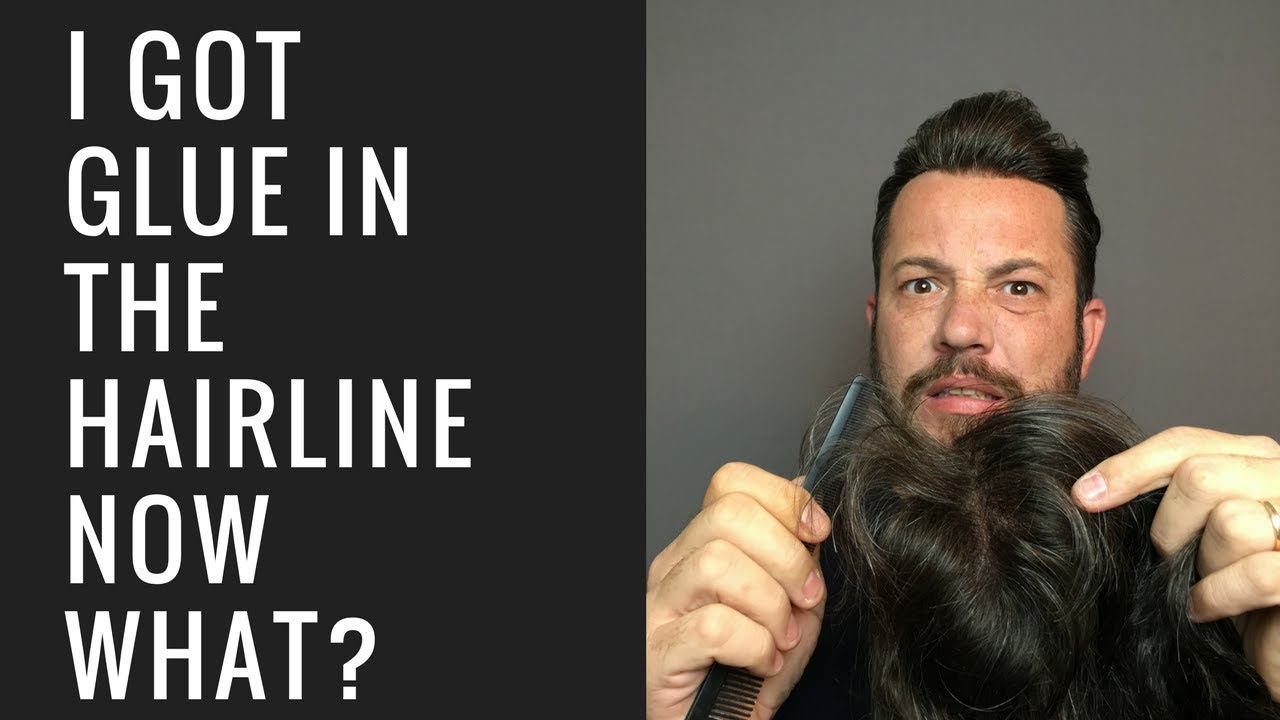 Hair Replacement Mens Hair System Review I Got Glue In The Hairline