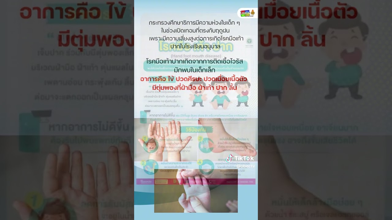 ศธ. ห่วงเปิดเทอม เด็กเล็กเสี่ยงโรคมือเท้าปาก แนะครูสังเกตอาการอย่างใกล้ชิด
