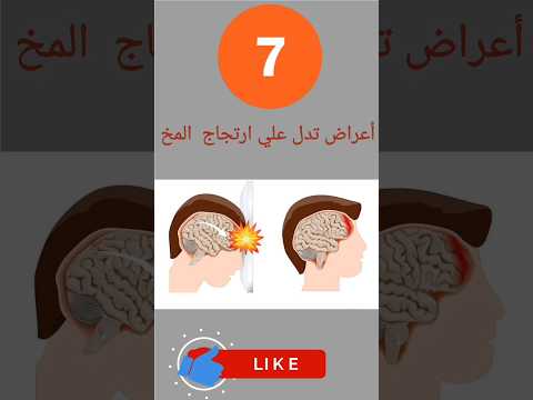 7 أعراض تدل علي ارتجاج المخ أعراض الارتجاج اعراض الارتجاج القئ التشنجات أسباب الإغماء