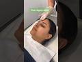 Peeled To Perfection A Step By Step Chemical Peel Treatment Results Laser Clinic Chemicalpeel 