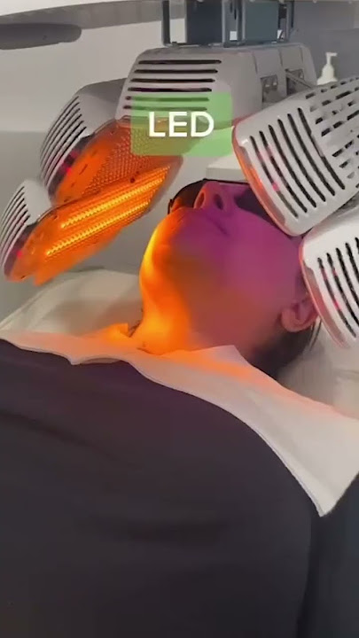 Peeled to Perfection! A step by step Chemical Peel treatment✨ | Results Laser Clinic #chemicalpeel