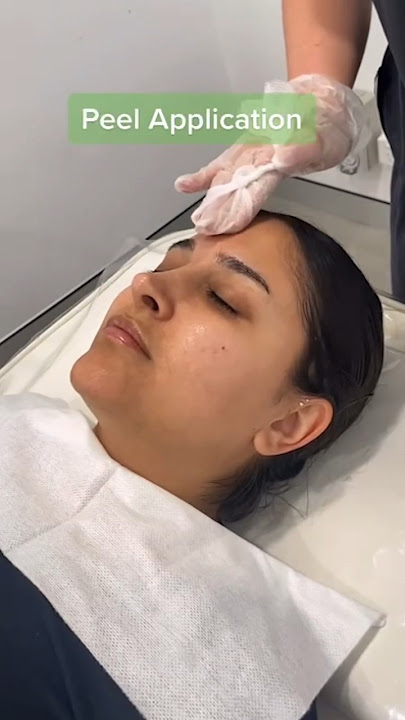 Peeled to Perfection! A step by step Chemical Peel treatment✨ | Results Laser Clinic #chemicalpeel