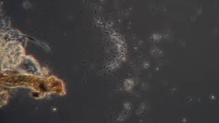Bacteria motility at 400X in phase contrast