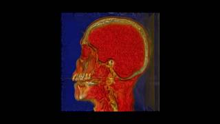 Celebrity AtomicusChart®: Volume Rendering Customizations Profile