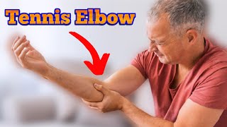 What is Tennis Elbow   Lateral Epicondylitis _ Elbow Pain ( cause , Treatment ) in hindi / Urdu