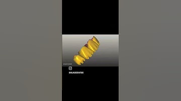 #shorts #2022 #dentist #photography #exocad #teeth #zirkonzahn #veneer #smile #اكسبلور #bhfyp