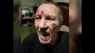 70 year old Uber driver beaten to pulp while 12 people watched. SHAME ON THEM.