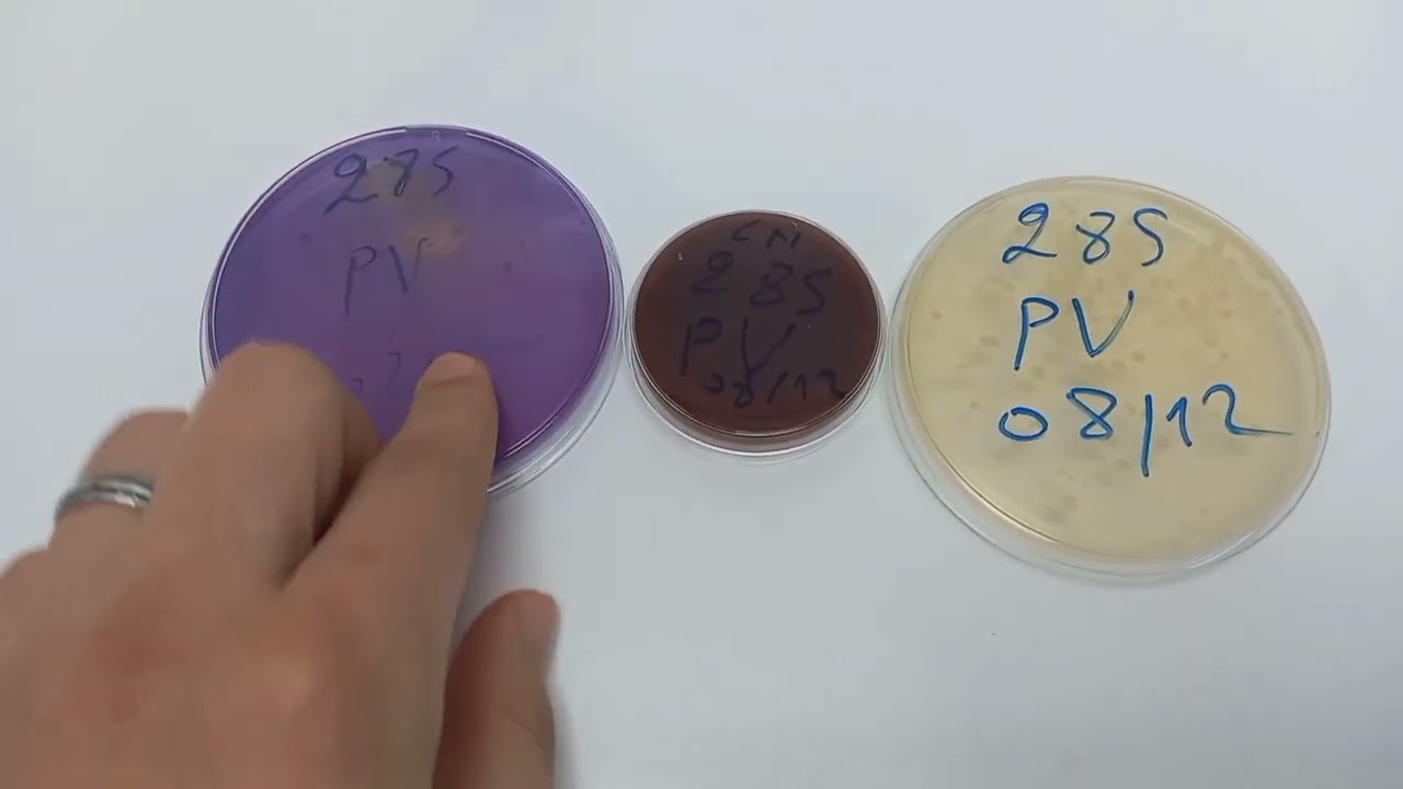vaginal sampling steps prélèvement vaginal #analysis تعلم مراحل تحليل المهبلي #عالم المختبرات