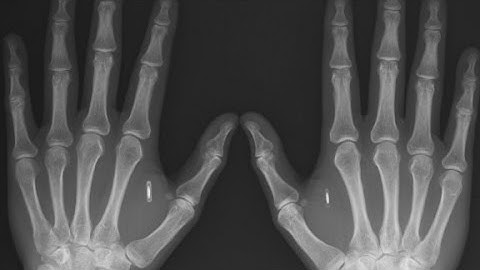 The business of being a cyborg