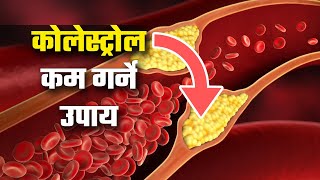 Cholesterol Control | How to Lower Cholesterol | Food to Lower Bad Cholesterol and Triglycerides