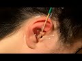 ASMR | 리얼에 리얼을 더한 진짜 귀청소&마사지 | Real ear cleaning and massage asmr