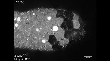 JBC : β-Spectrin Regulates the Hippo Signaling Pathway and Modulates the Basal Actin Network
