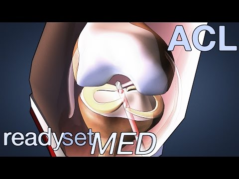 What is an Allograft Surgery? - ACL Series