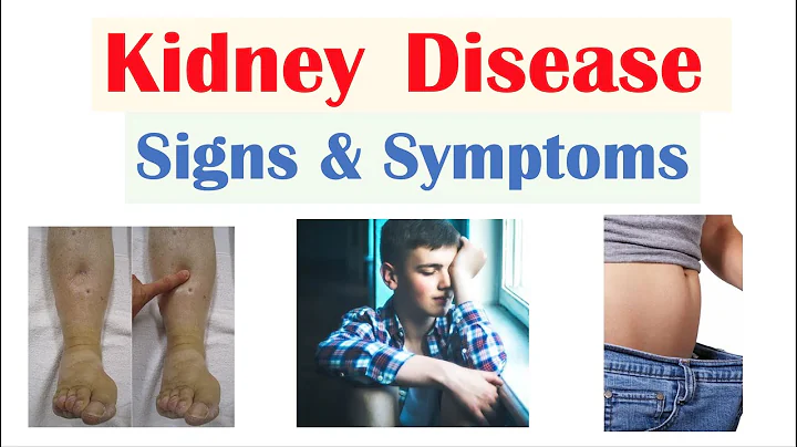 Kidney (Renal) Disease Signs & Symptoms (ex. Peripheral Edema, Fatigue, Itchiness) - DayDayNews