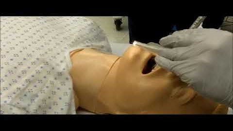 Tracheal intubation (lighted stylet)