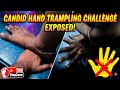 UNBELIEVABLE! Candid Hand Trampling Challenge:🦶💥| SrnStepZone #trample #candid #feet 
