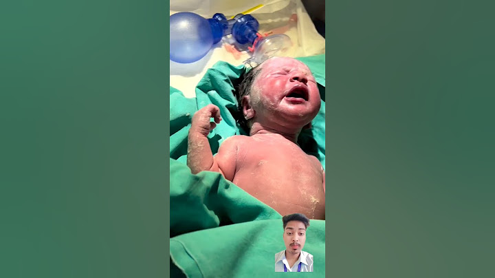 Angel born late at night🎈💕 #baby #neet #momlovestatus #birth #vlogging #youtubeshort