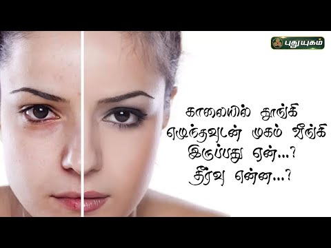 காலையில் தூங்கி எழுந்தவுடன் முகம் வீங்கி இருப்பது ஏன்...? தீர்வு என்ன...? | Dr.M.S.UshaNandhini