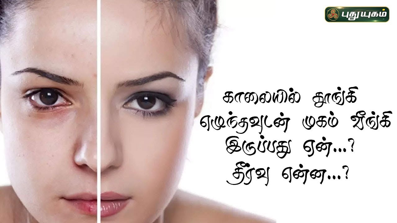 காலையில் தூங்கி எழுந்தவுடன் முகம் வீங்கி இருப்பது ஏன்...? தீர்வு என்ன...? | Dr.M.S.UshaNandhini