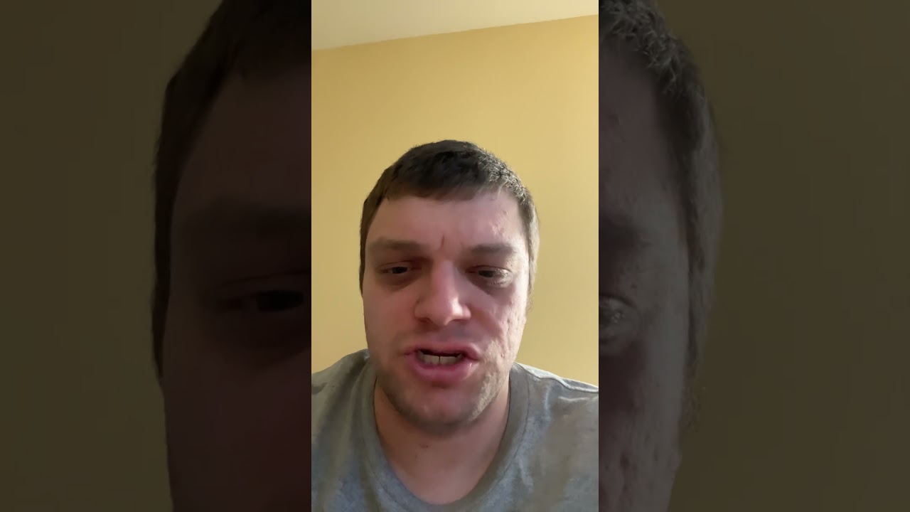 Алексей Навальный, как сообщается, был убит ядом древесной лягушки.