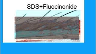 83667A2E9804EDF65E887B83CB0A45#1