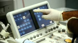 British Heart Foundation - Your Guide to TOE (Transoesophageal Echocardiogram), heart disease test